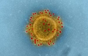 coronavirus 1 610x389 Detectan tres posibles casos de coronavirus en Jalisco