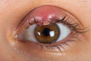 unam investiga extrano tratamiento para infecciones en los ojos UNAM investiga extraño tratamiento para infecciones en los ojos